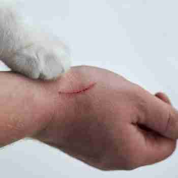 a close up of a hand with a cat scratch and a white cats paw